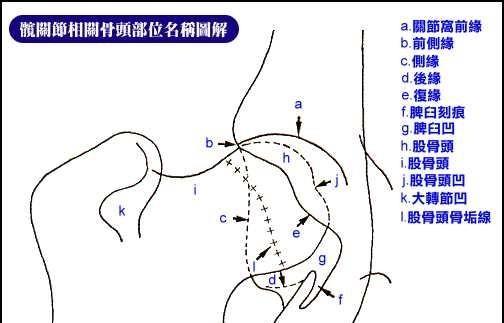 Sorting out the knowledge of CHD hip dysplasia in dogs