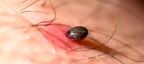 What if a dog is bitten by a tick? Teach you a quick and effective way.